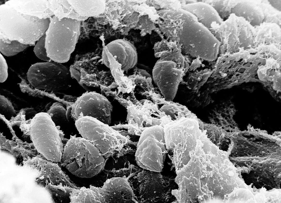 MEDIA FOR MEDICAL/UIG via Getty Images 
 Yersinia pestis bacterium that caused the bubonic plague, carried by infected fleas on rodents.