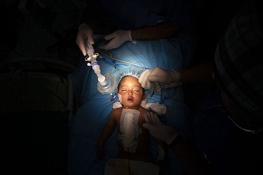 Yazan, 1, has his oxygen mask removed after his heart surgery at the Tajoura National Heart Center in Tripoli, Libya, on Feb. 27, 2020. Yazan&#146;s perilous trek from his small desert hometown culminated in a five-hour surgery. He is one of 1,000 children treated by Dr. William Novick&#146;s group since it first came to Libya after the 2011 uprising. (AP Photo/Felipe Dana)