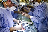 Cancer, heart surgeries delayed as coronavirus alters care
