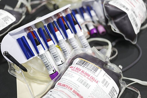 Vials of blood for testing and a donated bag of blood will be sent for testing and use from an American Red Cross blood drive at the Carbondale YMCA in Carbondale, Pa., on Thursday, March 26, 2020. The American Red Cross reports a critical need of blood due the coronavirus. (Jake Danna Stevens/The Times-Tribune via AP)