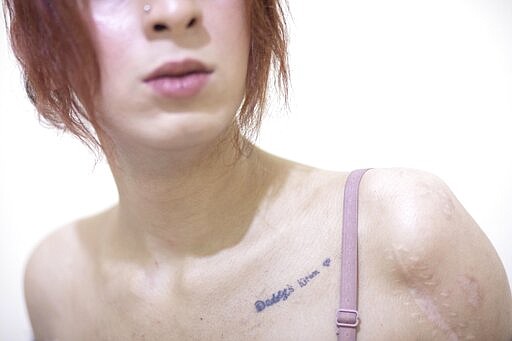 In this Feb. 18, 2020 photo, Egyptian transgender woman and activist Malak el-Kashif shows her tattoo and scars on her shoulder from a suicide attempt, in her bedroom, in Cairo, Egypt. El-Kashif's battles are etched on her slender body. The scars peeking underneath her top are from the time she threw herself from the fifth floor. The ones on her arm are a reminder of cutting herself with razors more times than she can count. (AP Photo/Nariman El-Mofty)