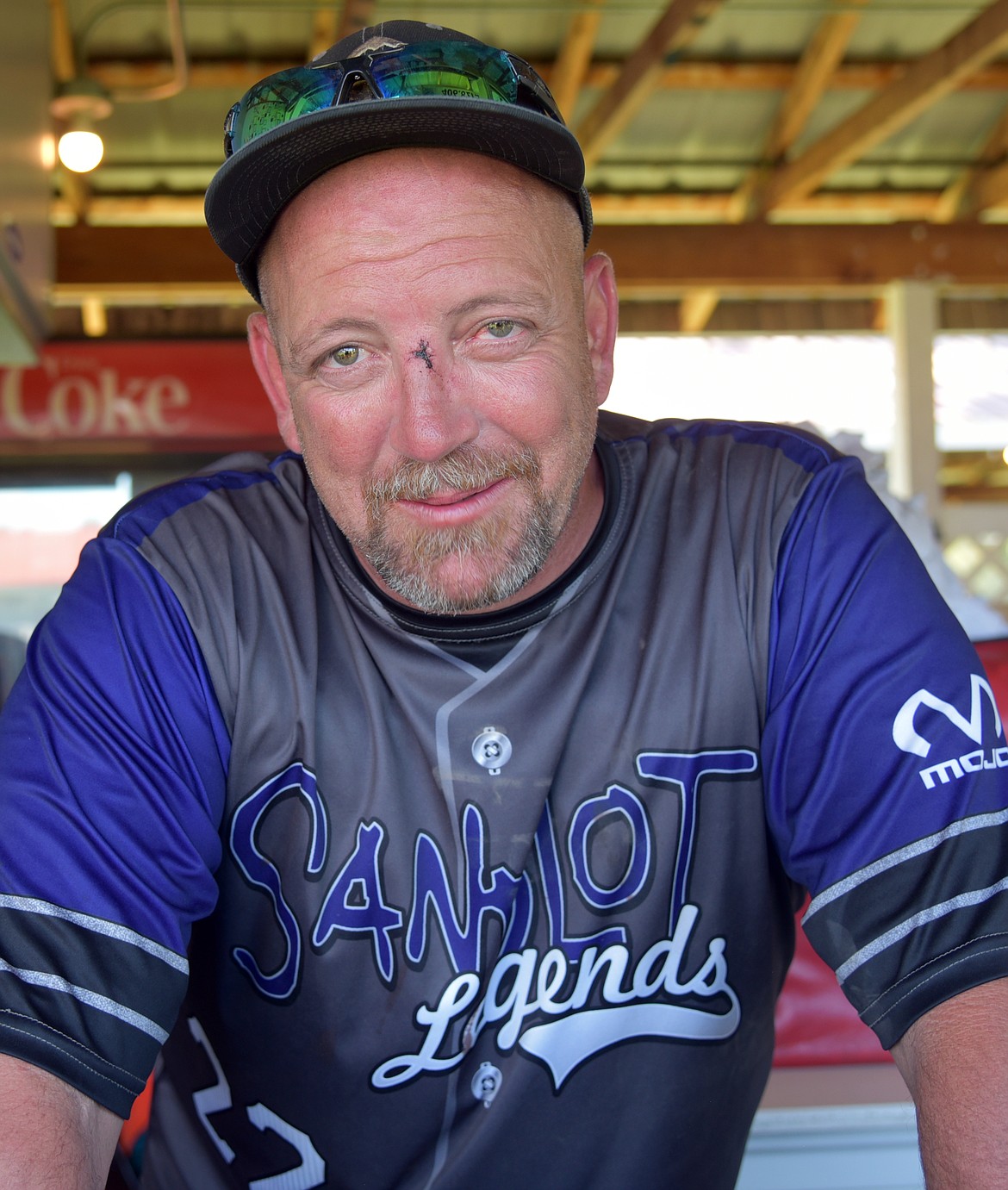 Shawn Purkeypule sports a few stitches where his face caught a ball in one of the co-ed softball games held as part of the Plains Summer kick-off.  He and his wife Shawna were the organizers of the new event.