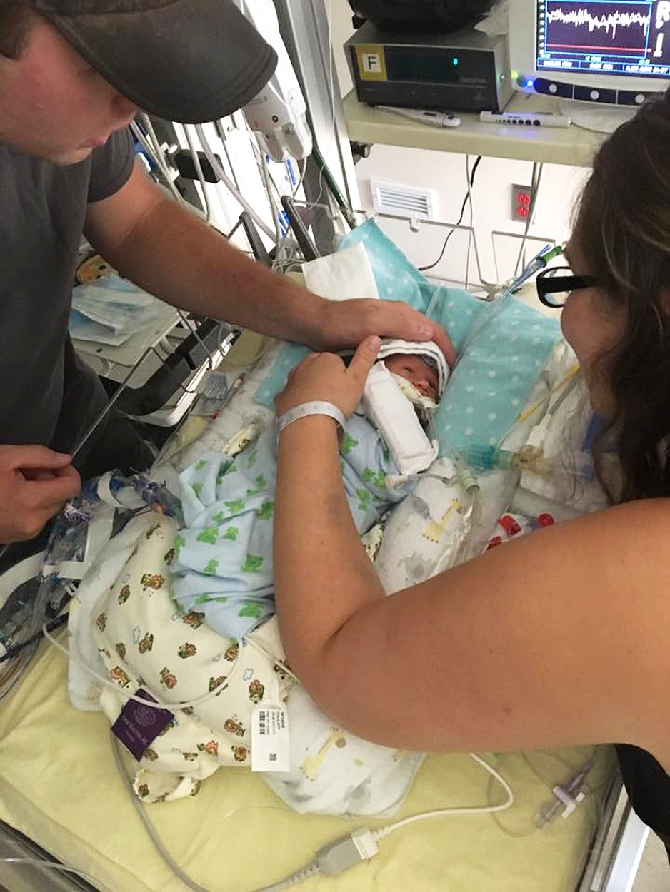 Jackson Stiffler and Brittany Ogle check on their newborn son, Leroy Stiffler at Seattle Children&#146;s Hospital. (Courtesy of Jolee Beaubien)