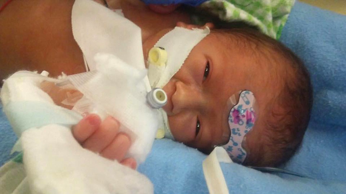 Leroy Stiffler undergoes treatment for generalized arterial calcification of infancy at Seattle Children&#146;s Hospital in August. Leroy was born via c-section at 32 weeks so doctors could begin treatment. (Courtesy of Joleen Beaubien)