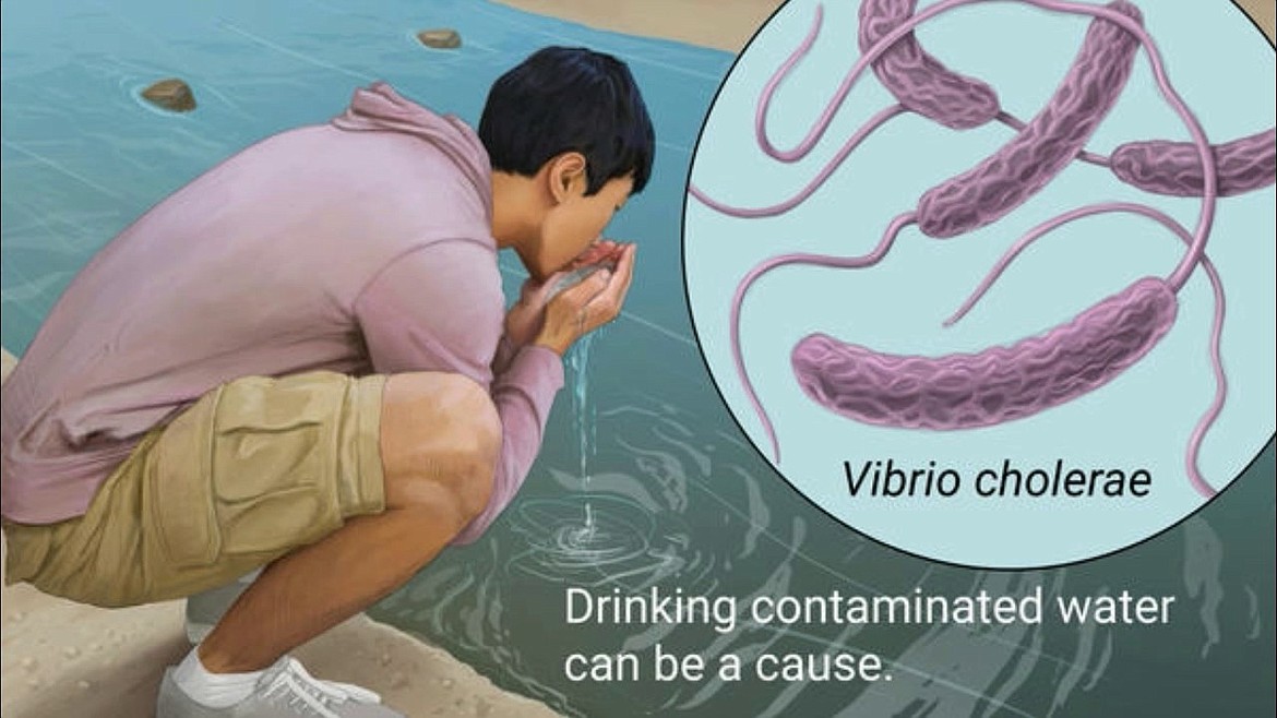YOUTUBE
Microscopic view of cholera bacteria Vibrio cholerae.