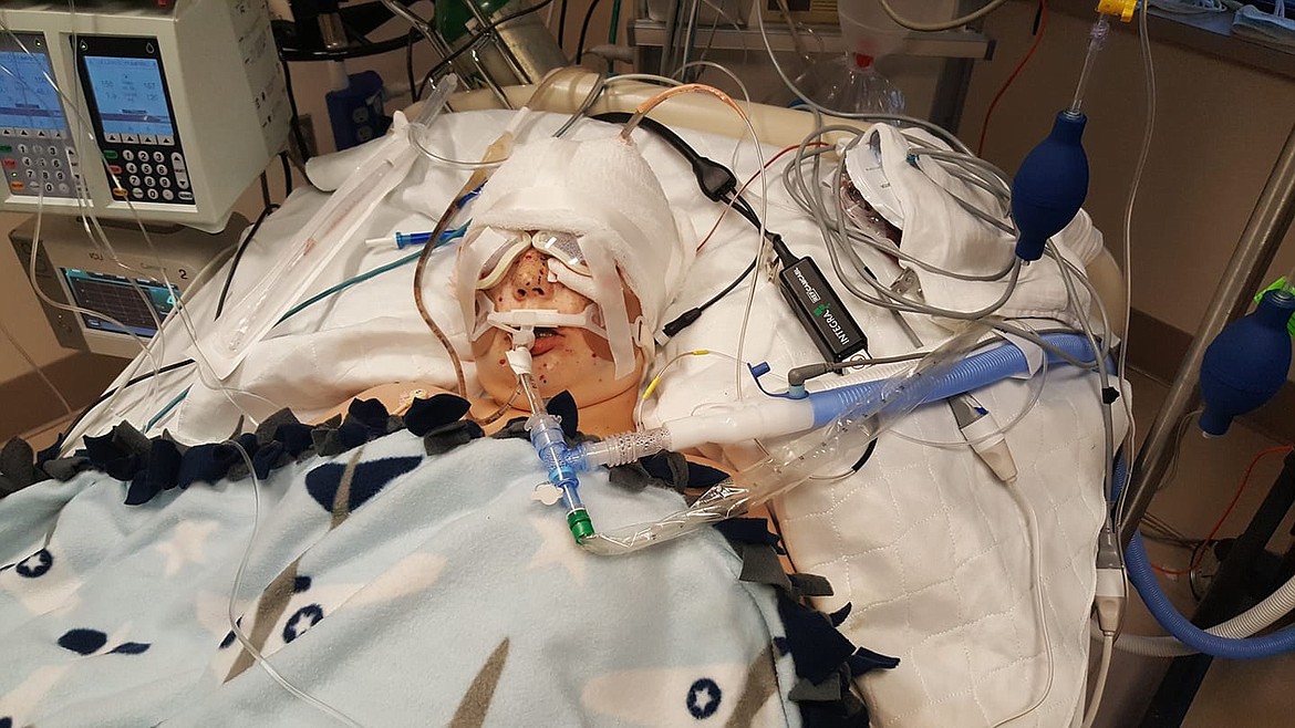 Jade Harlow, 13, is recovering at Sacred Heart in Spokane from facial wounds sustained by a shotgun in what was reported as an accidental shooting near Cataldo. (Courtesy photo)