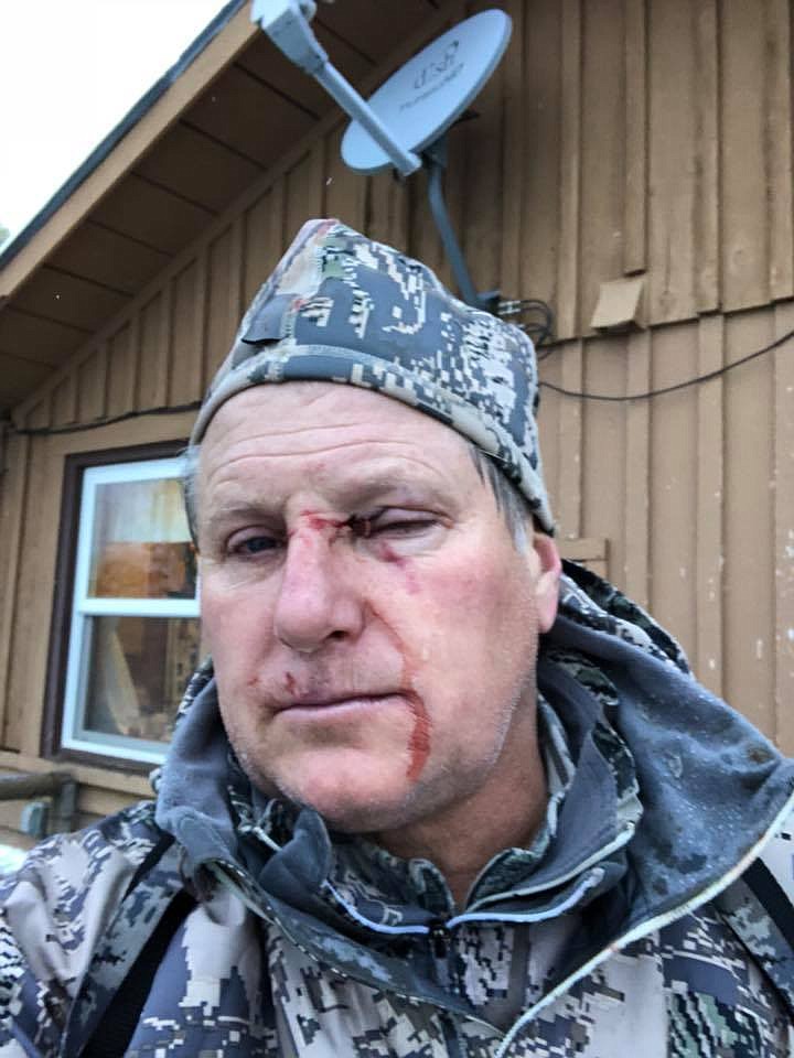 Hayden resident Bob Legasa was attacked by a female grizzly in the Montana wilderness early Saturday. He is recovering in a Bozeman hospital and should be released by Wednesday. &#147;I&#146;m feeling extremely lucky,&#148; he told The Press on Sunday afternoon. &#147;It was a fluke.&#148; (Courtesy photo)