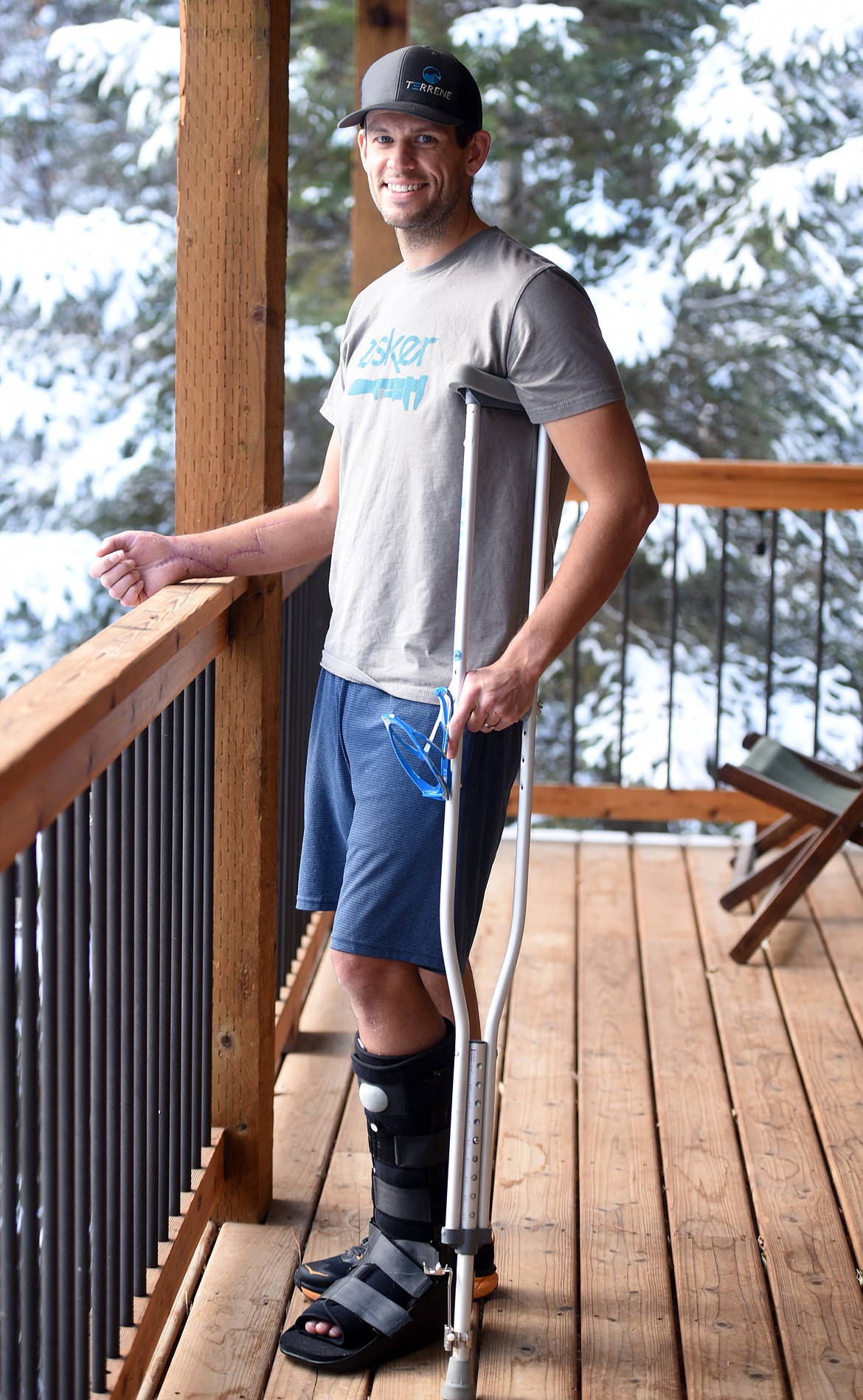 Portrait of Anders Broste on the back porch of his home in Columbia Falls. Broste has scars on both his arms and is still recovering from a grizzly attack on November 11.(Brenda Ahearn/Daily Inter Lake)