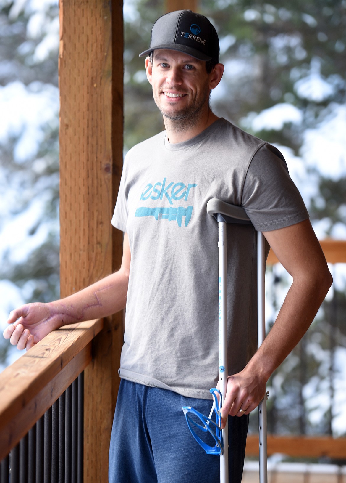 Anders Broste on the back porch of his home in Columbia Falls. Broste has scars on both his arms and is still recovering from a grizzly attack that occurred Nov. 11. (Brenda Ahearn/Daily Inter Lake)