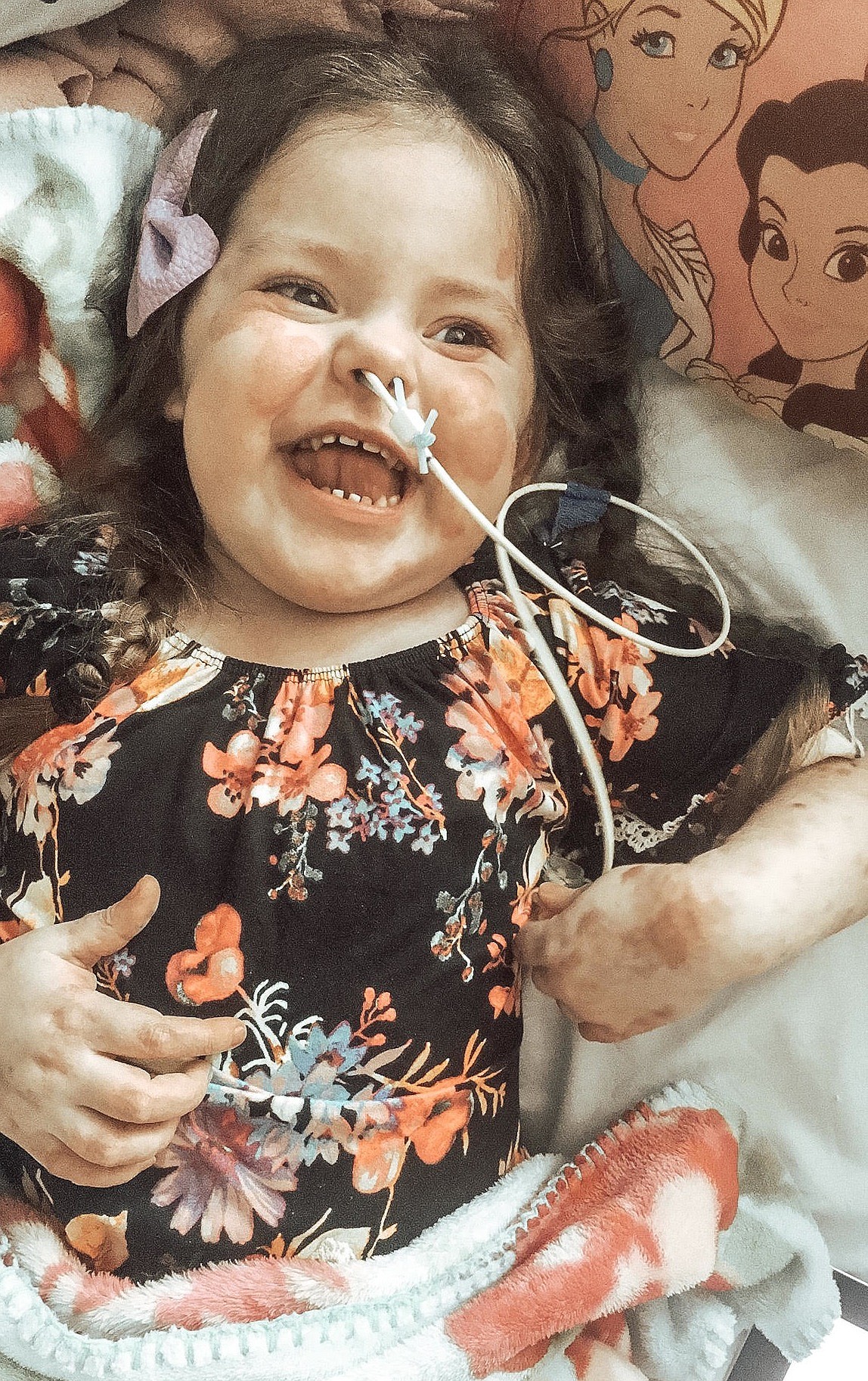 Courtesy photo
Alexandria Cresci&#146;s mother, Kayla, calls her 4-year-old daughter a &#147;walking miracle.&#148; The girl has to be kept in isolation to not acquire an infection or virus, due to having a rare disease called complete DiGeorge Anomaly.