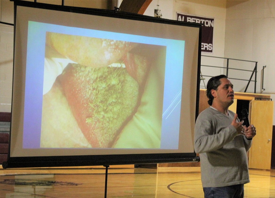 GREG BILBY, a part of the Tobacco Tour presentation held on March 21 at area high schools, shows students a photo of cancer growth on the taste buds of a tongue caused by tobacco use. (Kathleen Woodford/Mineral Independent)