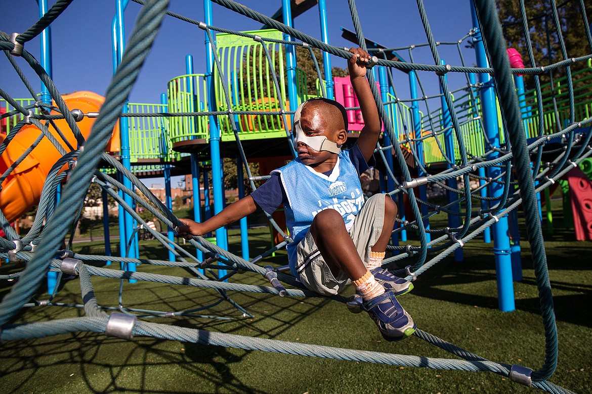 &lt;p&gt;TESS FREEMAN/Press&lt;/p&gt;&lt;p&gt;Leo, 4, climbs through the rope play structure on the playground at McEuen Park on Friday, Oct. 10, 2014. Leo is from Mabamda, Burundi and fell on a cooking fire where he was stuck for several minutes. He was brought to Boston for reconstructive surgery three months ago.&lt;/p&gt;