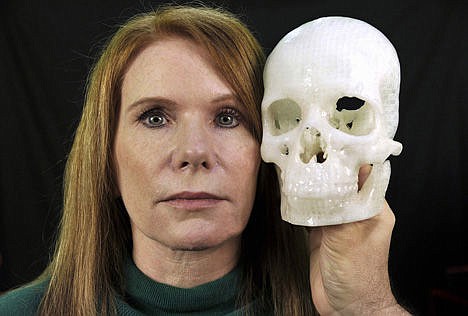 &lt;p&gt;Pamela Shavaun Scott holds a 3D printer model of her skull after her brain tumor was removed from behind her eye, in Morro Bay, Calif., Jan. 13.&lt;/p&gt;