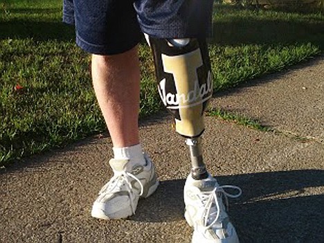 &lt;p&gt;Earlier, Jim Miller Jr. wrapped the Vandal &quot;I&quot; logo around the socket of his prosthesis.&lt;/p&gt;