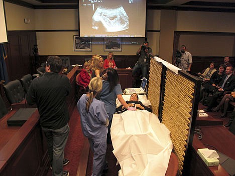 &lt;p&gt;A woman identified as &quot;Lorena&quot; by anti-abortion advocates during an ultrasound exhibition in the Idaho Capitol undergoes an abdominal ultrasound on Wednesday, March 21, 2012 in Boise. The exhibition was held by proponents of a bill to require an ultrasound before an abortion that's passed the Idaho Senate 23-12. Foes of the measure say it's an invasion of privacy. (AP Photo/John Miller)&lt;/p&gt;