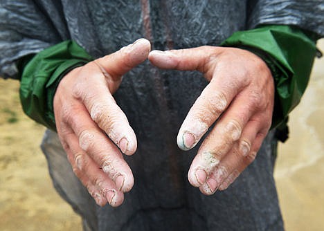 &lt;p&gt;Hiker Justin Lichter shows his hands that were affected by wet weather after arriving at the southern terminus of their historic journey on the Pacific Crest Trail at the Mexican border near Campo, Calif., on March 1.&lt;/p&gt;