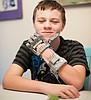 Boy receives mechanic Cyborg hand from far reaches of the internet