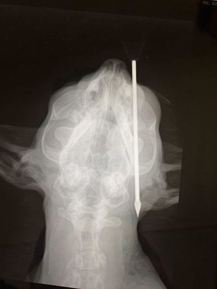 &lt;p&gt;This X-ray image shows how a 4.5-inch blow dart went into Red's head.&lt;/p&gt;