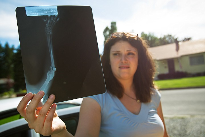 &lt;p&gt;Ami Manning views an x-ray of the pellet that was shot into her cat's leg.&lt;/p&gt;