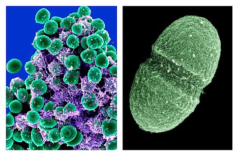 &lt;p&gt;At left, undated handout image provided by the National Institute of Allergy and Infectious Diseases (NIAID) shows a clump of Staphylococcus epidermidis bacteria (green) in the extracellular matrix, which connects cells and tissue, taken with a scanning electron microscope, showing. At right, undated handout image provided by the Agriculture Department showing the bacterium, Enterococcus faecalis, which lives in the human gut, is just one type of microbe that will be studied as part of NIH's Human Microbiome Project. They live on your skin, up your nose, in your gut _ enough bacteria, fungi and other microbes that collected together could weigh, amazingly, a few pounds. Now scientists have mapped just which critters normally live in or on us and where, calculating that healthy people can share their bodies with more than 10,000 species of microbes. (AP Photo/NIAID, Agriculture Department)&lt;/p&gt;