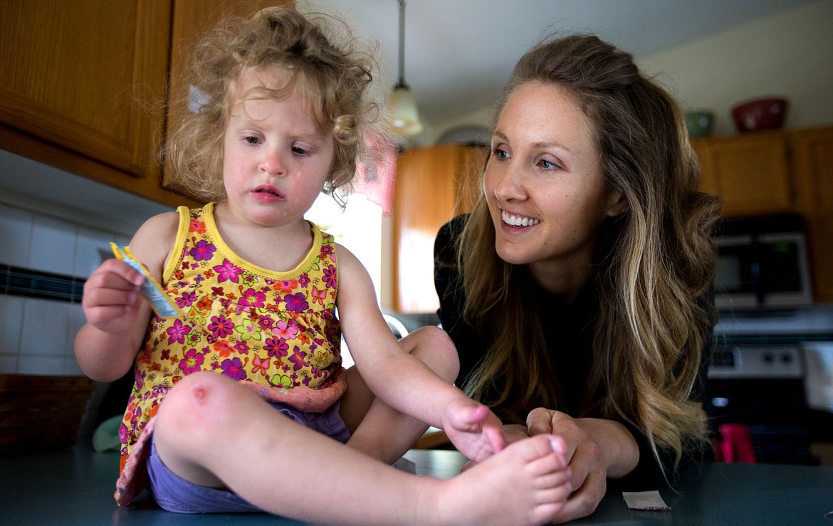 &lt;p&gt;Lauren Agostinelli watches her 2-year-old daughter, Eden, apply antibacterial cream to her skinned knee Tuesday in their Post Falls home.&lt;/p&gt;