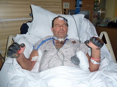 &lt;p&gt;This photo supplied by the Gaylord family taken July 6, 2012, at a hospital in Bend, Ore., shows Paul Gaylord as he recovers from the plague. Gaylord contracted the disease when he tried to pull a mouse out of the mouth of his cat, Charlie, because it was choking on the rodent. The disease, a version of the medieval scourge that wiped out at least a third of Europe, took away the 59-year-old welder's fingertips, his toes and his ability to make a living. He faces an arduous recovery surrounded by constant reminders of his misery, the infected cat died, and the trailer he's living in has a mouse problem. (AP Photo/The Gaylord Family, ho)&lt;/p&gt;