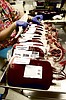 Tests aim to settle if fresher blood works better