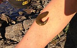 Hot summer weather brings out lake leeches