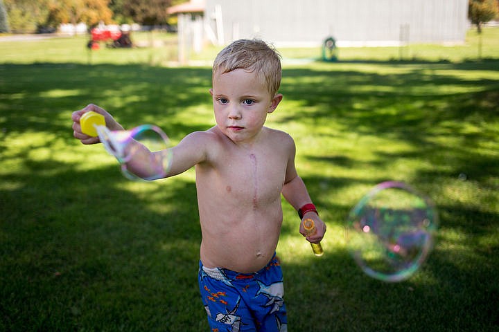 &lt;p&gt;Eli Ashby, 4, concentrates as he creates bubbles on Friday afternoon in his grandparents' backyard in Dalton Garden. Eli has undergone two open heart surguries, one of which was to install a mechanical mitral heart valve.&lt;/p&gt;