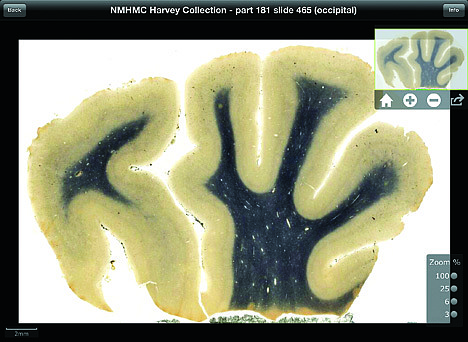 &lt;p&gt;This digitized image made from a screen shot of a new iPad app, provided Sept. 24, 2012 by the National Museum of Health and Medicine Chicago, shows an image of brain tissue from renowned theoretical physicist Albert Einstein. The new application to be released Tuesday, Sept. 25 will allow users to see Einstein's brain as if they were looking through a microscope. The application promises to make detailed images of his brain more accessible to scientists than ever before. Teachers, students and anyone who's curious also can get a look. (AP Photo/Courtesy the National Museum of Health and Medicine Chicago)&lt;/p&gt;