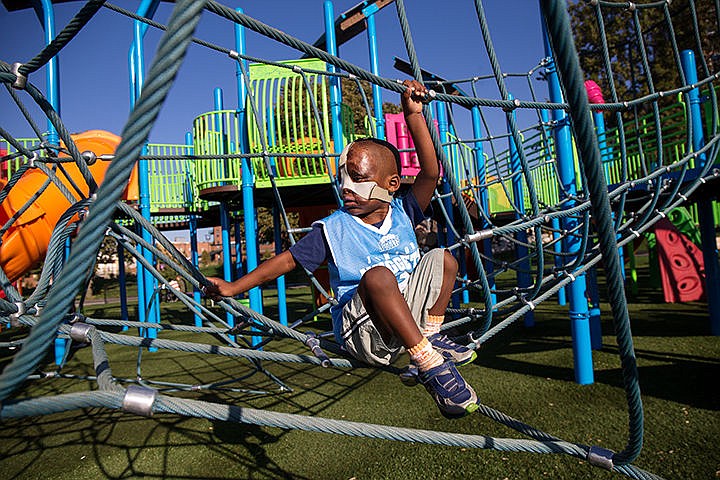 &lt;p&gt;Leo, 4, climbs through the rope play structure on the playground at McEuen Park on Friday morning. Leo is from Mabamda, Burundi and fell on a cooking fire where he was stuck for several minutes. He was brought to Boston for reconstructive surgery three months ago.&lt;/p&gt;