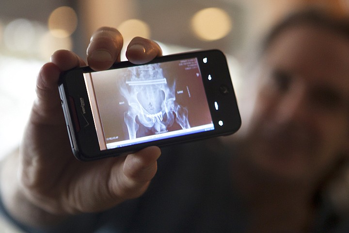 &lt;p&gt;Blaine Wright displays an X-Ray of his pelvis.&lt;/p&gt;