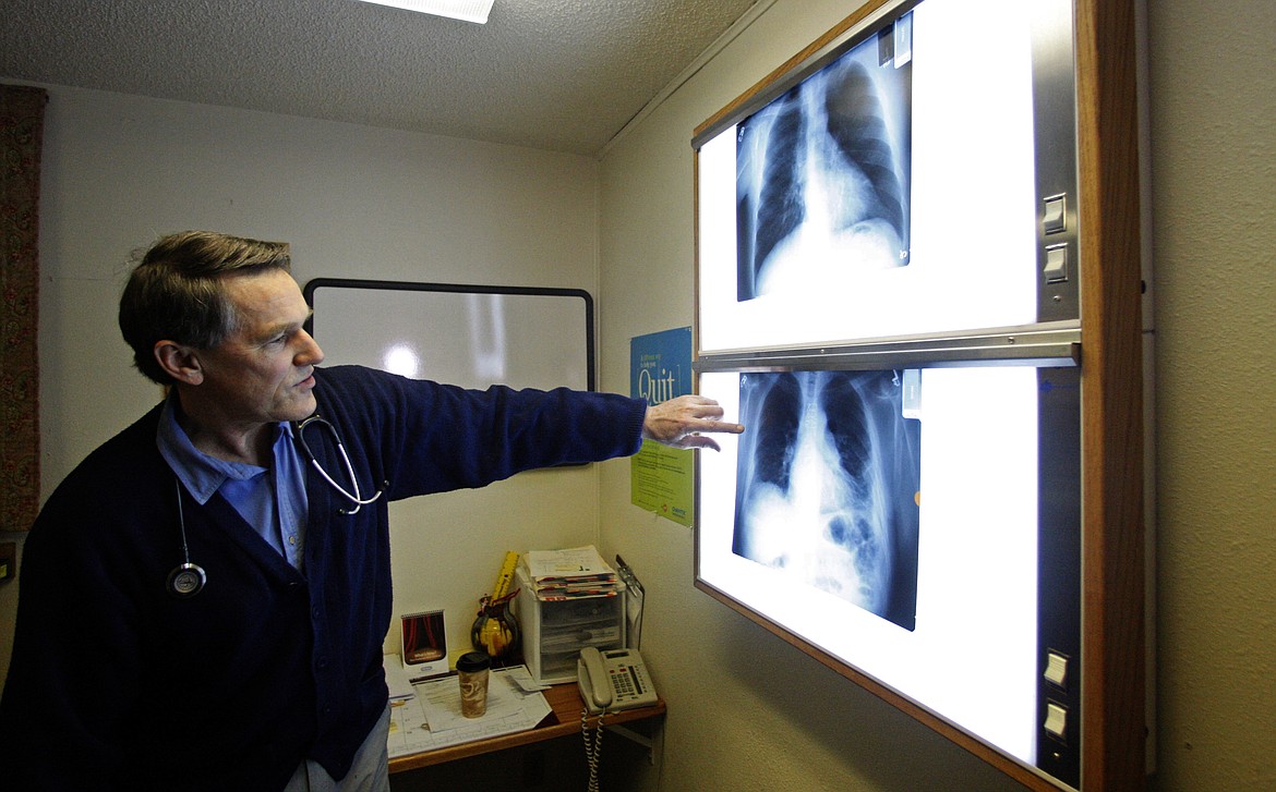 FILE - In this Feb. 18, 2010 file photo, Dr. Brad Black, director of the Libby, Mont., asbestos clinic, looks at X-rays. A doctor in Libby since 1977, Black has been at the front lines of Libby's asbestos fight. State regulators are taking over responsibility for protecting residents of Libby and nearby Troy from exposure to asbestos that remains after a decades-long cleanup of the communities. (AP Photo/Rick Bowmer, File)