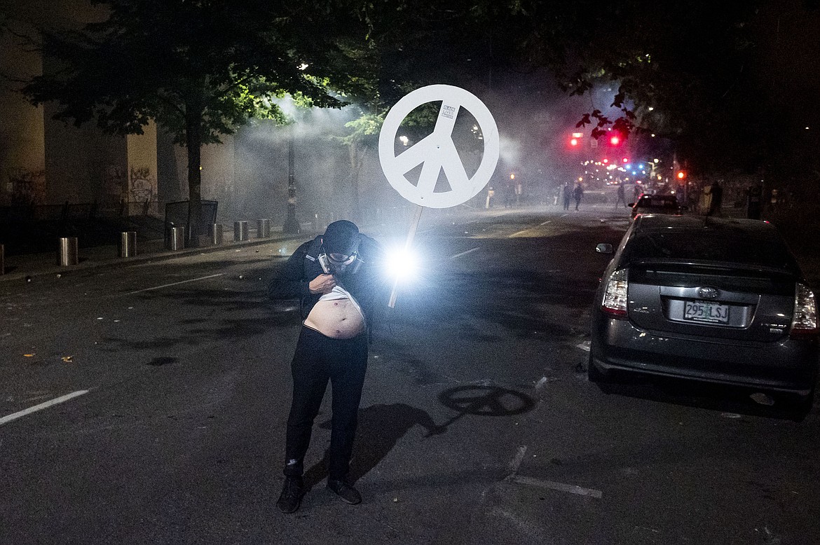 William Isham examines wounds after federal officers used teargas and projectiles to disperse Black Lives Matter protesters at the Mark O. Hatfield United States Courthouse on Monday, July 20, 2020, in Portland, Ore. Portland police early Monday detailed another night of conflict between protesters and federal forces outside the U.S. courthouse in Oregon's largest city, including a small fire outside the building and tear gas deployed to disperse the crowd. (AP Photo/Noah Berger)