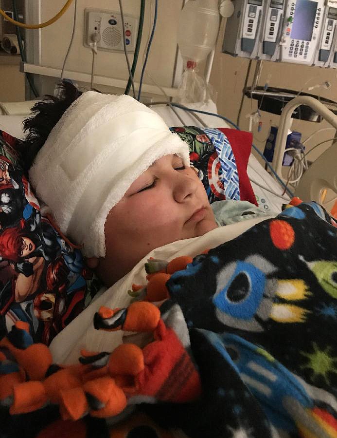 Coeur d'Alene 14-year-old and Lake City High freshman Jacob Markham is recovering after an emergency surgery Dec. 3 to remove a rare type of mass that had been growing in his brain. "He’s always had this, but we found out two weeks ago," his mom Christy Markham said. "Our lives won't be the same after this."