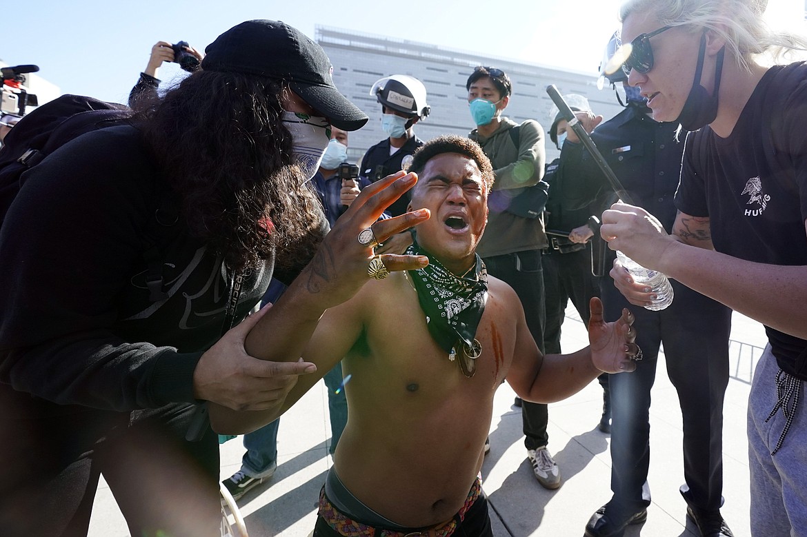 A counter demonstrator, center, yells after getting maced in the face by far-right demonstrators outside of City Hall Wednesday, Jan. 6, 2021, in Los Angeles. Demonstrators supporting President Donald Trump are gathering in various parts of Southern California as Congress debates to affirm President-elect Joe Biden's electoral college victory.