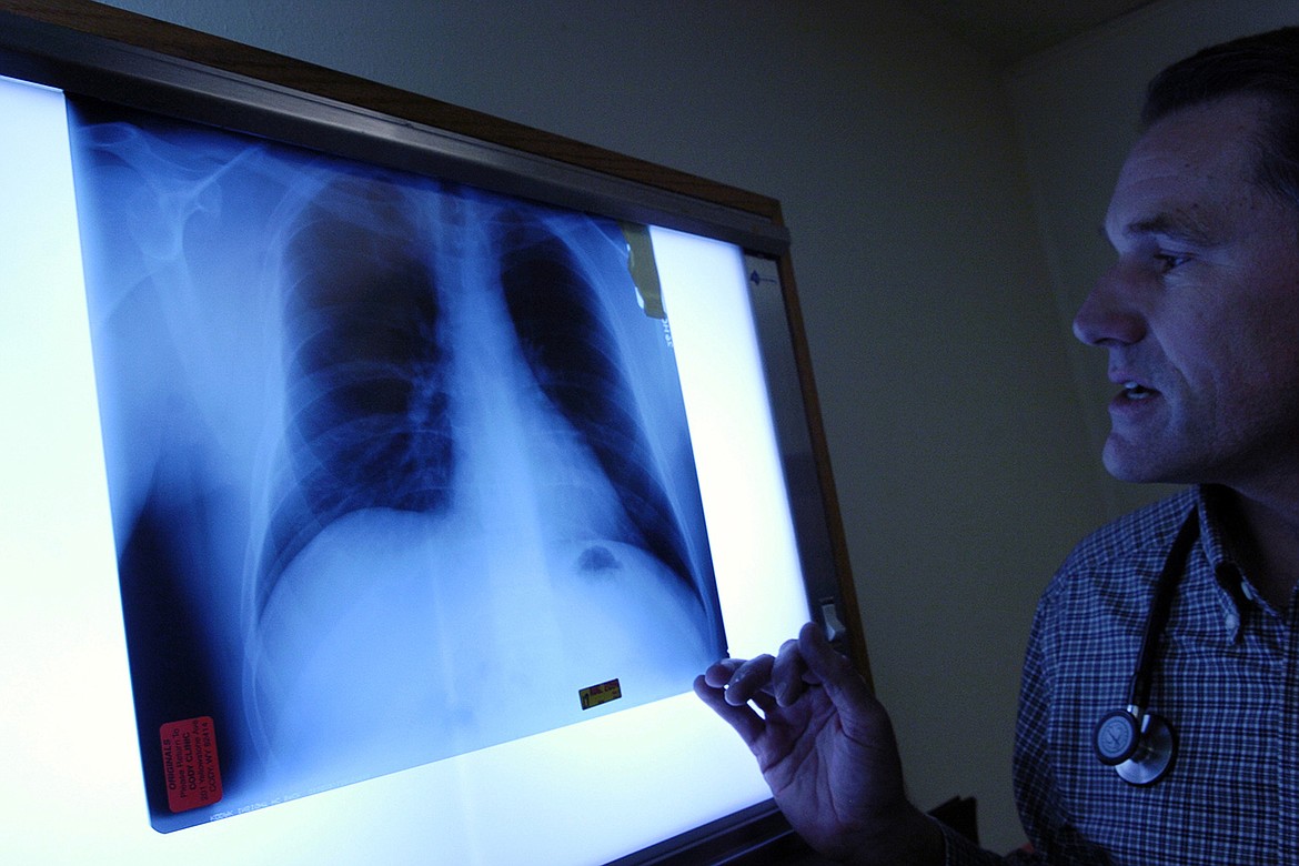 Dr. Brad Black examines an x-ray in the Center for Asbestos Related Disease clinic in Libby, Montana, in 2006. (Karl Gehring/Getty Images)