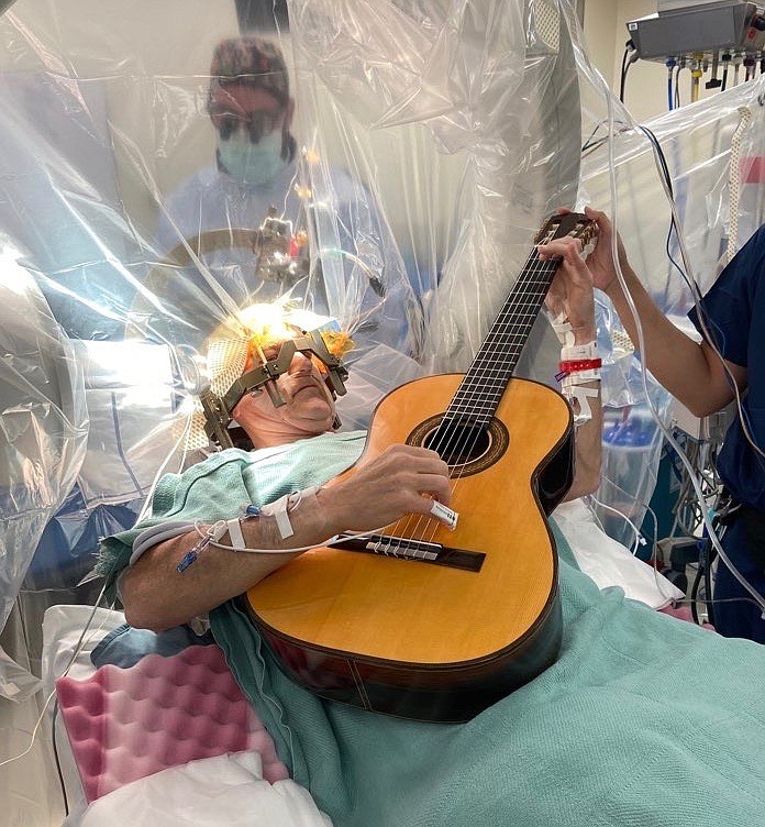 Jim Stroud plays the guitar while undergoing brain surgery at the National Institutes of Health in Bethesda, Maryland. Stroud is part of a trial to treat focal hand dystonia, which left him unable to play classical guitar. (Courtesy photo)