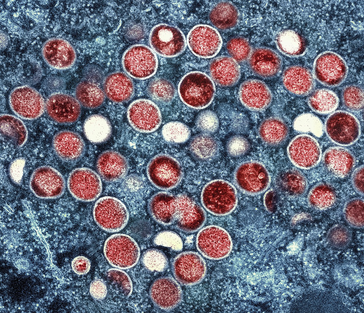 This image provided by the National Institute of Allergy and Infectious Diseases (NIAID) shows a colorized transmission electron micrograph of monkeypox particles (red) found within an infected cell (blue), cultured in the laboratory that was captured and color-enhanced at the NIAID Integrated Research Facility (IRF) in Fort Detrick, Md.