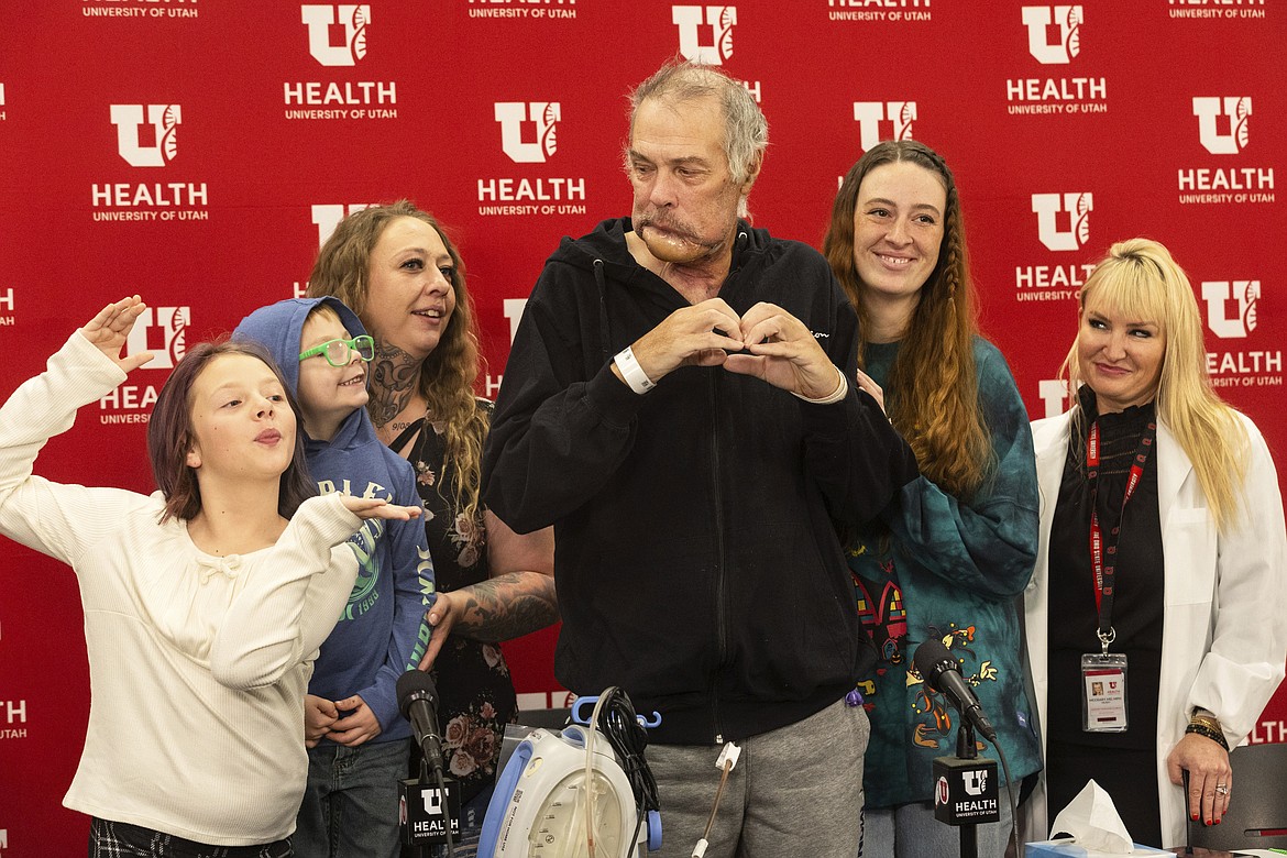 Rudy Noorlander is joined by his daughters, Ashley Noorlander, third left, and KateLynn Noorlander Davis, second right, grandchildren and surgeon Hilary McCrary, right, at a press conference where they talked about Noorlander's recovery from a grizzly bear attack at the University of Utah Hospital in Salt Lake City, Friday, Oct. 13, 2023. Noorlander was attacked by a grizzly bear on Sept. 8, 2023, south of Big Sky, Mont. After emergency surgery in Bozeman, Noorlander was flown to the University of Utah Hospital where he has continued his care. (Megan Nielsen/The Deseret News via AP)