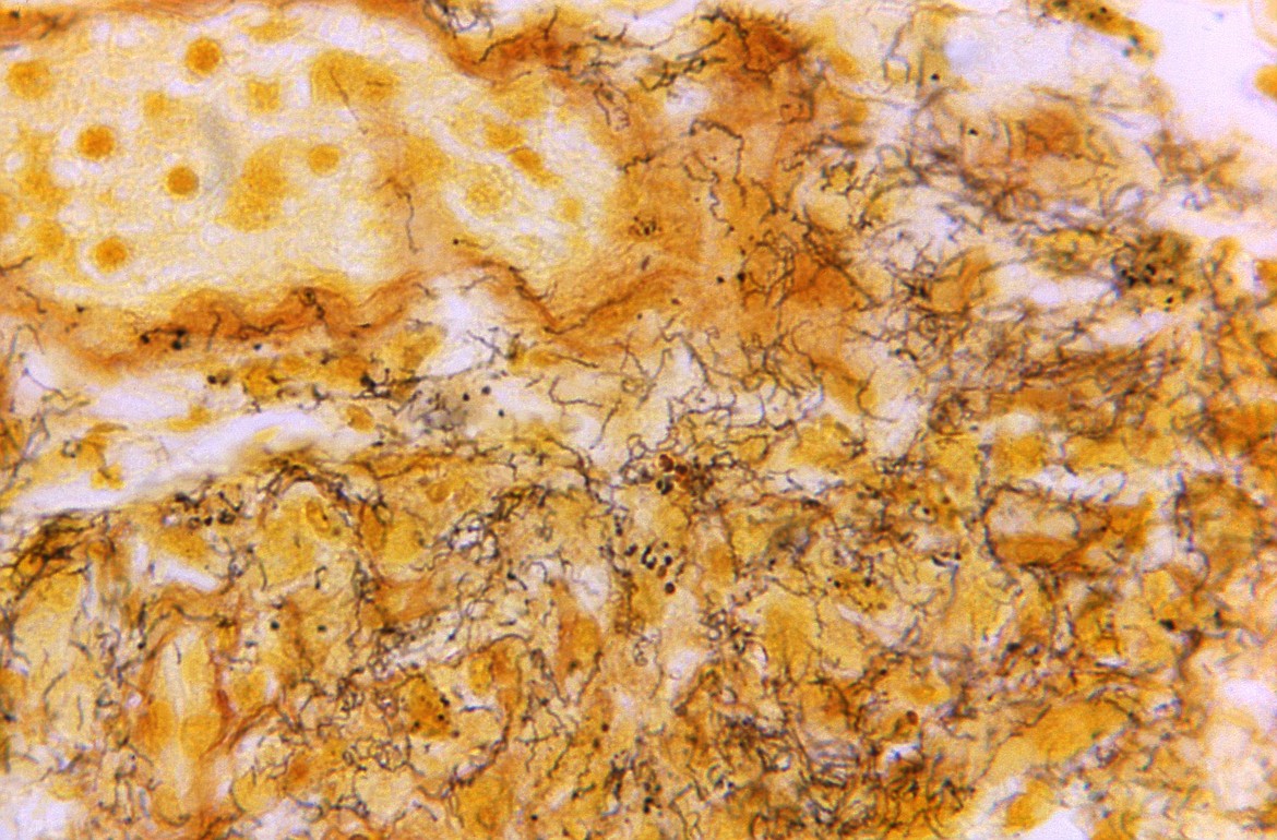 This 1966 microscope photo made available by the Centers for Disease Control and Prevention shows a tissue sample with the presence of numerous, corkscrew-shaped, darkly-stained, Treponema pallidum spirochetes, the bacterium responsible for causing syphilis. The U.S. syphilis epidemic continues to worsen, according to a new government report released Tuesday, Jan. 30, 2024, that also contains some unexpected good news — the rate of new gonorrhea cases has fallen for the first time in a decade. (Skip Van Orden/CDC via AP, File)