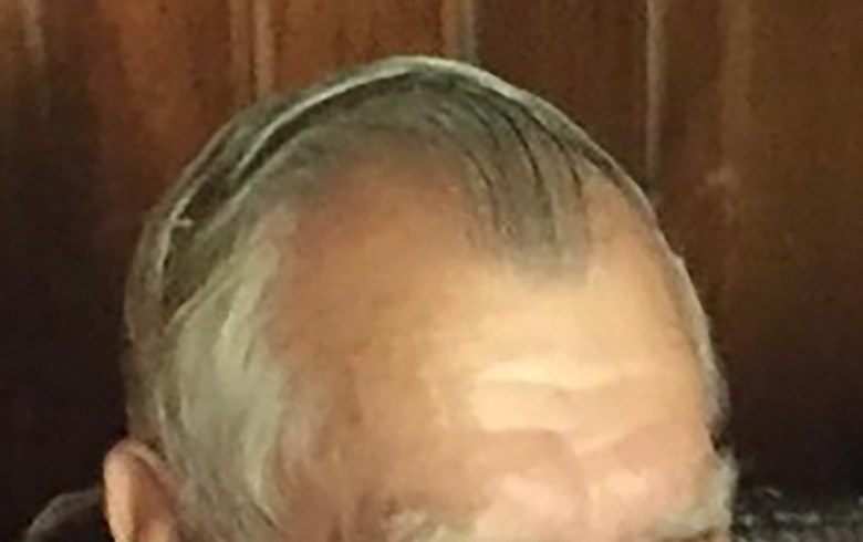 Lead