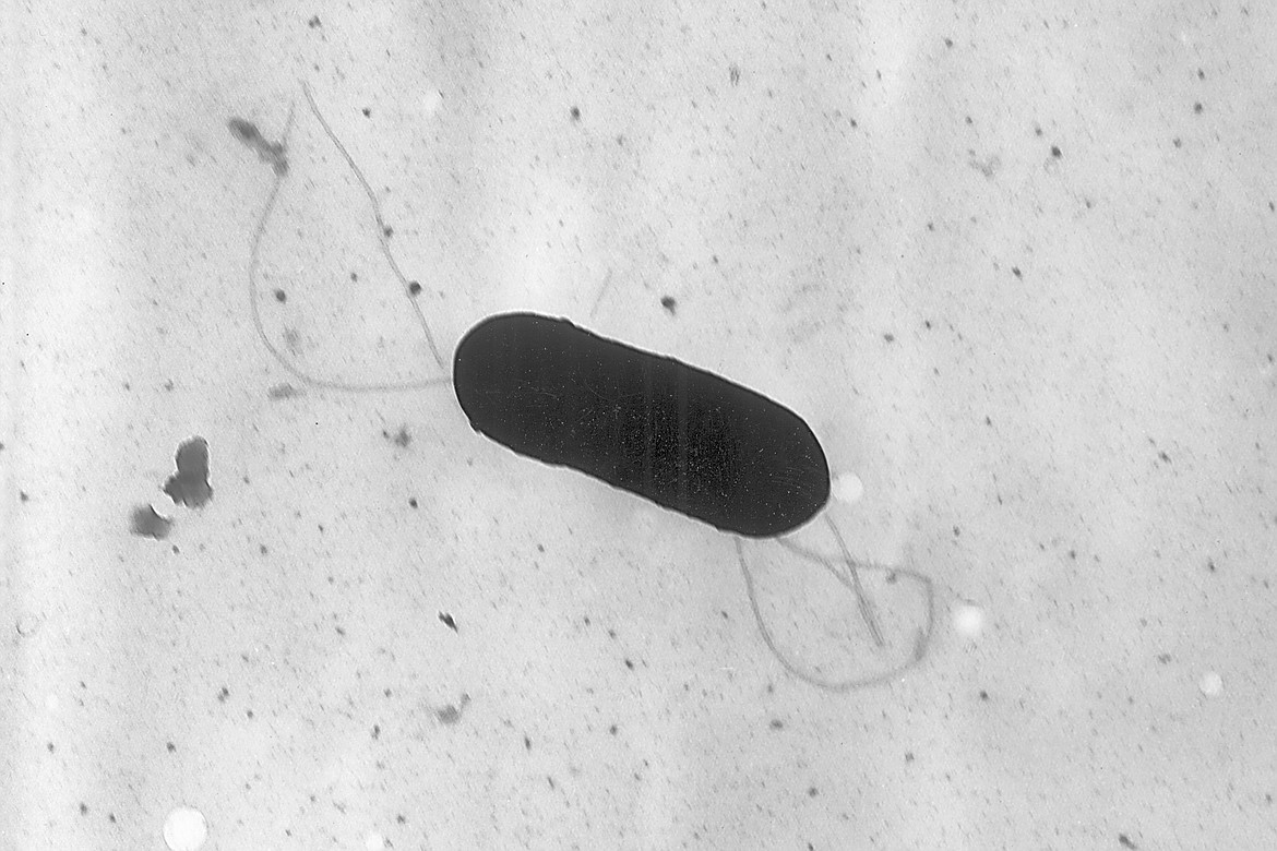 This 2002 electron microscope image made available by the Centers for Disease Control and Prevention shows a Listeria monocytogenes bacterium. Health officials have announced a recall of liverwurst and deli meat products, Friday, July 26, 2024, in connection with a national listeria outbreak that has sickened nearly three dozen people in 13 states. (Elizabeth White/CDC via AP, File)