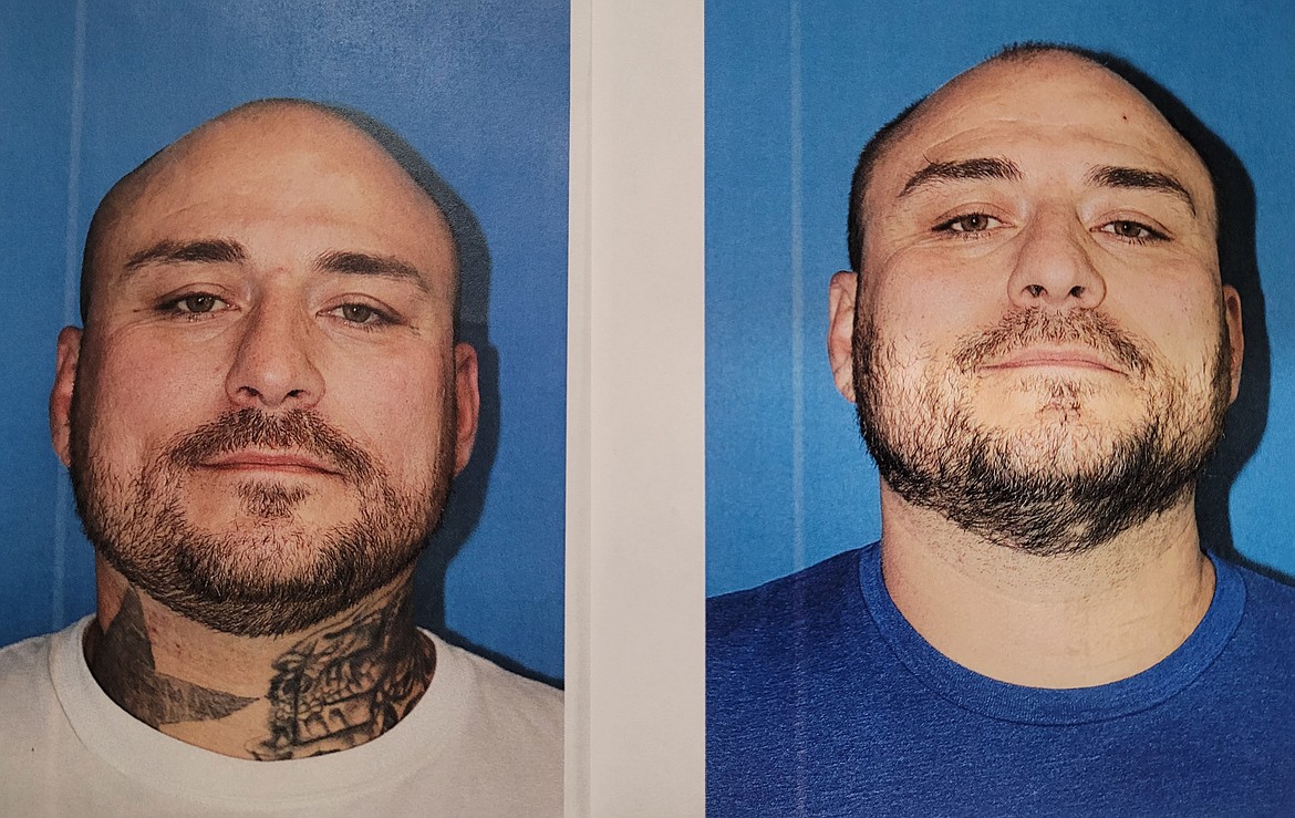 Paul Myers before his laser-removal procedures, left, and after.