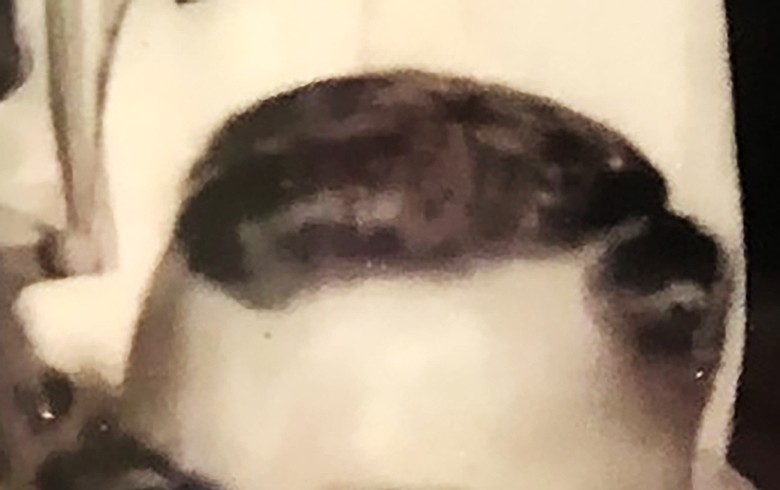 Lead