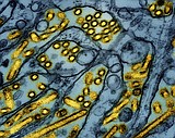 California declared an emergency over bird flu. How serious is the situation?