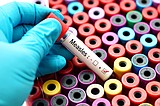 Measles detected in wastewater in Coeur d’Alene. But no Idaho cases reported amid national outbreak.