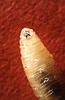 Person in US is diagnosed with New World screwworm parasite