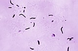Global tuberculosis diagnoses rise to a record, but deaths fall, WHO reports