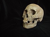 Ancient teeth from Siberia rewrite the plague’s timeline, dating back to over 5,500 years ago